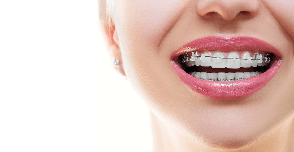 nzoz ortodoncja, rodzaju wady, kolorze zęba, niezwykle ważne, centrum ortodoncji, idealnym rozwiązaniem, konsultację, specjalisty, ortodoncja i stomatologia