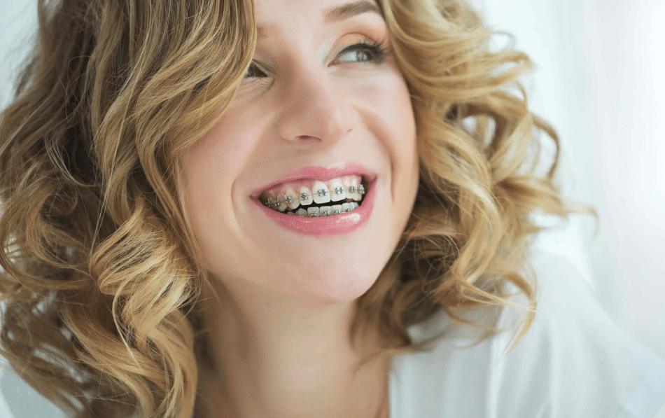 ortodonta Kraków, krzywe zęby, łuku zębowym, gabinet stomatologiczny, efekt leczenia, pomocą specjalnych klejów, mniej widoczne, odpowiednie metody, piękny uśmiech