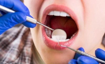 Czy implant zęba może się złamać